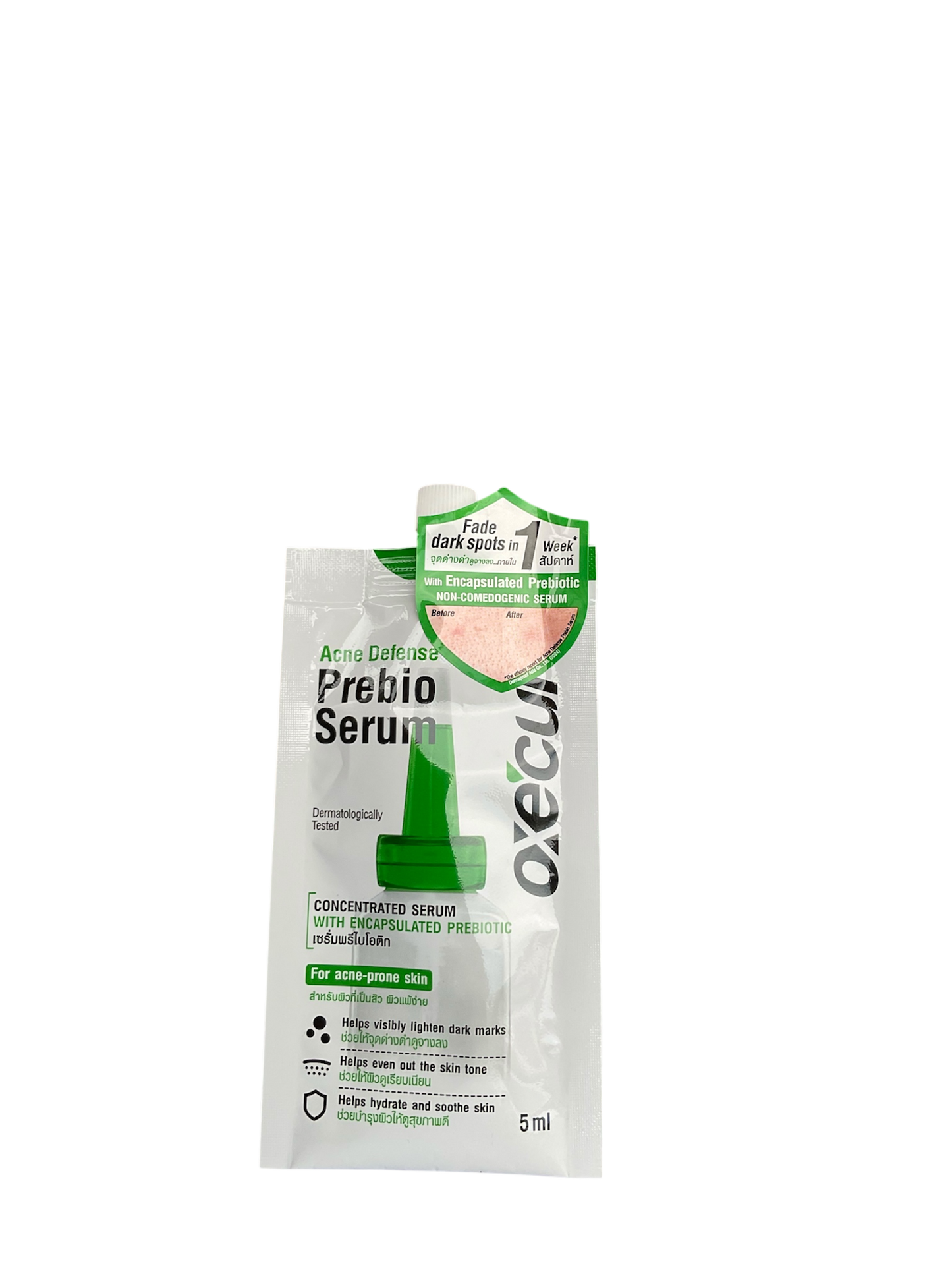 Oxecure Acne Defense Prebio Serum – Fade Dark Spots in 1 Week